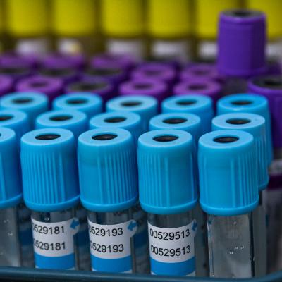 Anticuerpos en Sangre